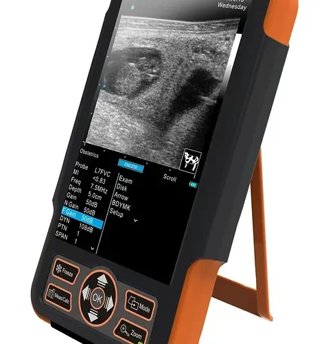 SIUI Ecógrafo CTS 800